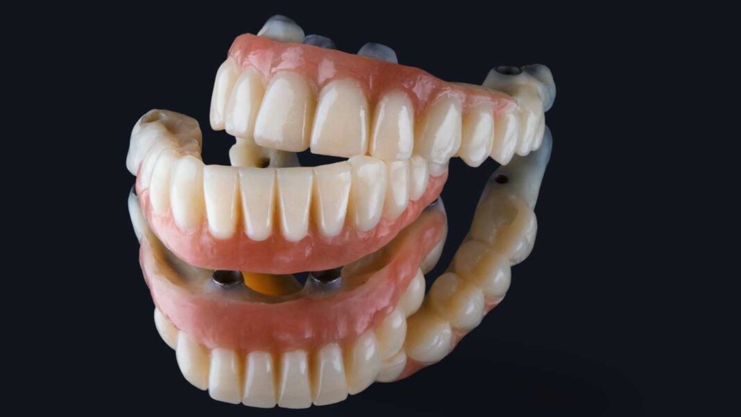 Cele mai cunoscute boli care duc la pierderea dintilor