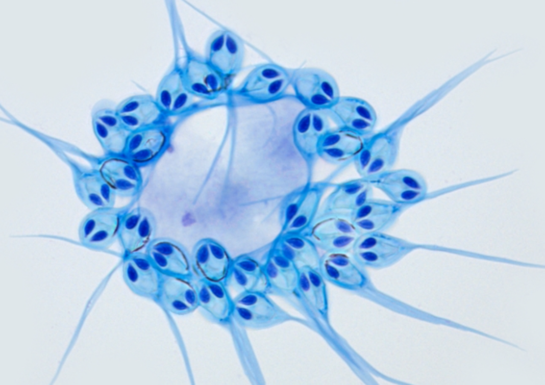 Un parazit, asemănător meduzei, nu are nevoie de oxigen pentru a trăi