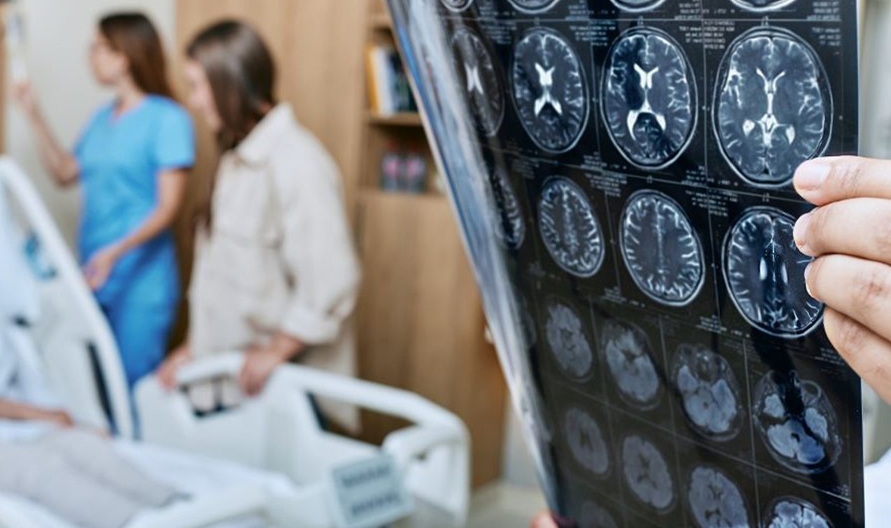 Poza pentru articolul Primul algoritm medical din România pentru estimarea riscului de Alzheimer: Tehnologia în serviciul prevenției